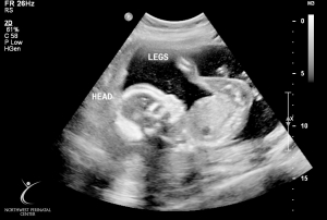 ultrasound 2014-12-10 05.jpg